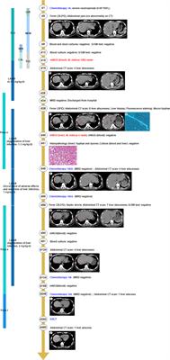 Mucor indicus caused disseminated infection diagnosed by metagenomic next-generation sequencing in an acute myeloid leukemia patient: A case report